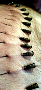 Needles